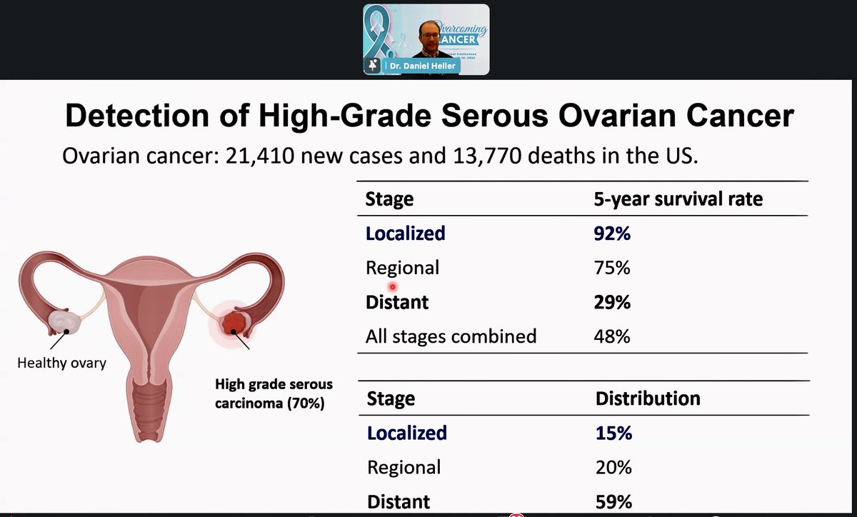 Ovarcome (@ovarcome) on Twitter photo Dr. <a href="/Dan_A_Heller/">Daniel Heller</a> presenting on the Role of AI in Ovarcoming Ovarian Cancer - Day 1 of our Annual Conference, Ovarcoming Cancer. Future forward presentation, bringing so much HOPE! This is how #WeOvarcome! 🩵 
#KnowShowGrowOvarcome #OvarianCancerAwarenessMonth #OvarCon2025 Dr. <a href="/Dan_A_Heller/">Daniel Heller</a> presenting on the Role of AI in Ovarcoming Ovarian Cancer - Day 1 of our Annual Conference, Ovarcoming Cancer. Future forward presentation, bringing so much HOPE! This is how #WeOvarcome! 🩵 
#KnowShowGrowOvarcome #OvarianCancerAwarenessMonth #OvarCon2025
