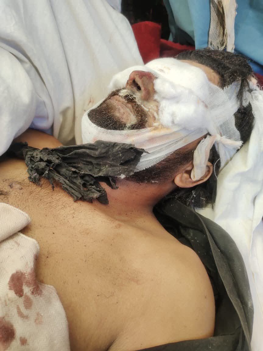 𝗣𝗮𝗸𝗶𝘀𝘁𝗮𝗻𝗶 𝗙𝗼𝗿𝗰𝗲𝘀 𝗖𝗮𝗿𝗿𝘆 𝗢𝘂𝘁 𝗔𝗲𝗿𝗶𝗮𝗹 𝗕𝗼𝗺𝗯𝗶𝗻𝗴 𝗼𝗻 𝗥𝗲𝘀𝗶𝗱𝗲𝗻𝘁𝗶𝗮𝗹 𝗛𝗼𝗺𝗲𝘀 𝗶𝗻 𝗭𝗲𝗵𝗿𝗶: 𝗧𝘄𝗼 𝗪𝗼𝗺𝗲𝗻 𝗮𝗻𝗱 𝗮 𝗠𝗮𝗻 𝗞𝗶𝗹𝗹𝗲𝗱, 𝗙𝗶𝘃𝗲 𝗜𝗻𝗷𝘂𝗿𝗲𝗱,
facebook.com/share/p/1BhwJx…
#StopBalochGenocide