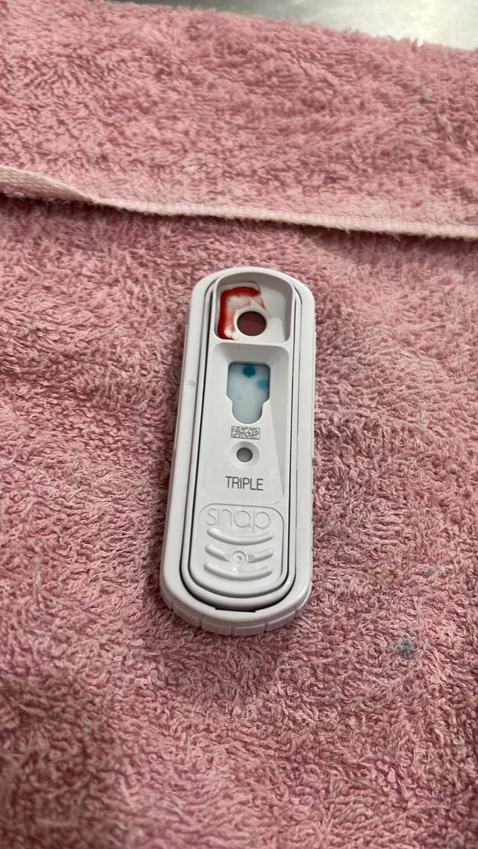 HerrerFx's tweet image. Hi, many don’t know me but I want to share my cat’s situation: my loyal therapy kitty was diagnosed with leukemia and FIP. I’m also in psychiatric treatment and struggling financially. I’m offering art commissions or donations:
 
ko-fi.com/herrerfox