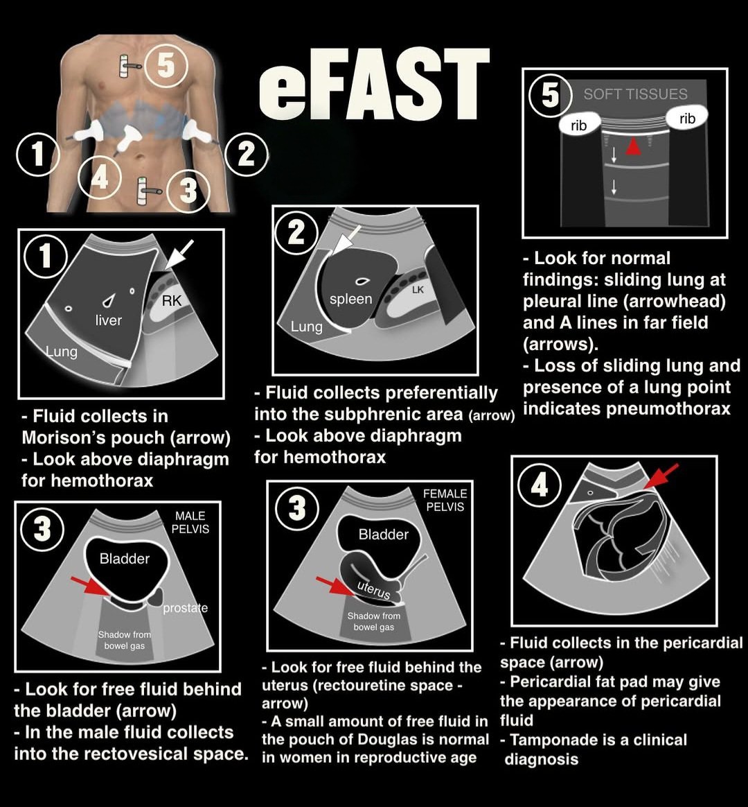 #ultrasound 
#sonologist
