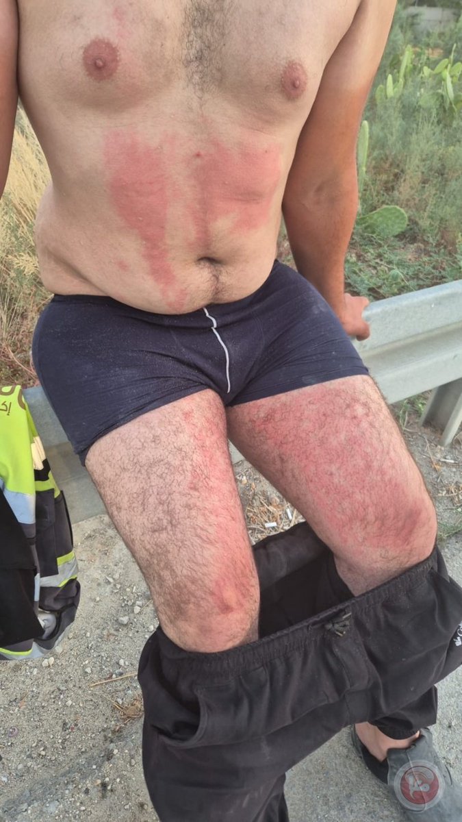 Following the shooting and stabbing operation at Al-Karameh Crossing today, carried out by a Jordanian aid truck driver, 60 Palestinian truck drivers were severely beaten by Israeli apartheid forces as retribution and suffered minor to moderate injuries. 20 were transferred to a