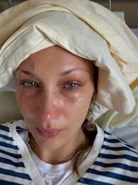 Bella Hadid/Genç model/ Lyme hastası/antibiyotik alıyor 

MK / Genç Türk/ Lyme +Bartonella hastası/ antibiyotik alamıyor !

Devlet hastanesindeki doktorunun kapısına gidip anlatmama rağmen vermedi. Hatta kimliğini goster dedi bana. Gösterdim. Elimden çekti aldı. İşlem