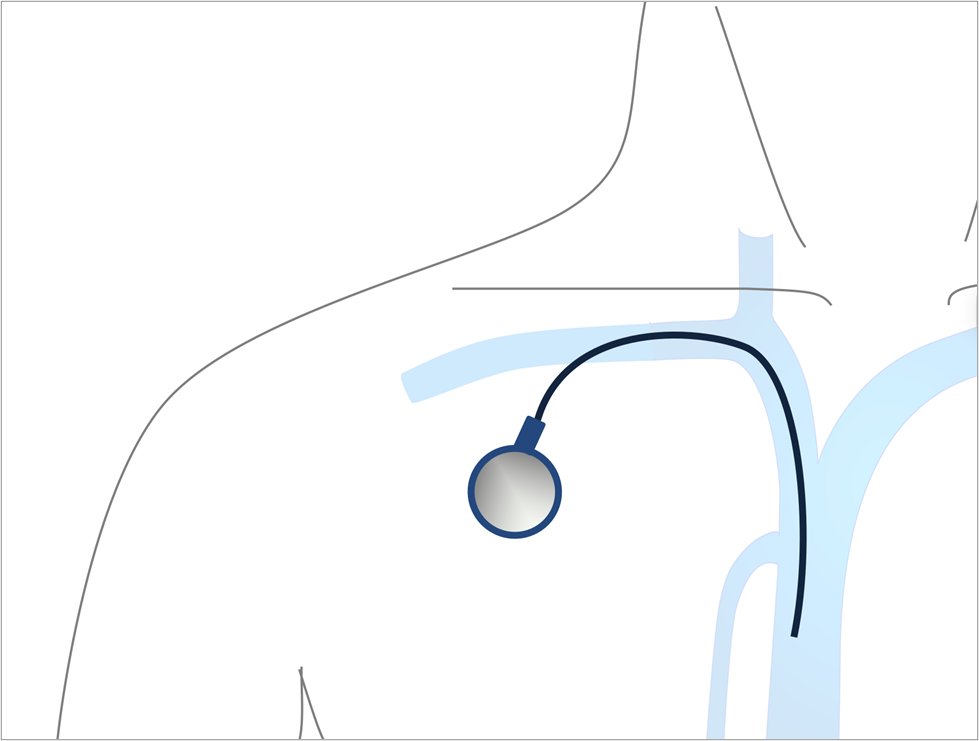 [ATLAS HP]
ATLAS HP international medical care blog "NCC today" has been updated!
#31 Supporting Cancer Care with Central Venous Ports: Safe and Reliable IR Procedures

atlas.ncc.go.jp/en/internation…

#NCC #Cancer #Oncology #ClinicalResearch