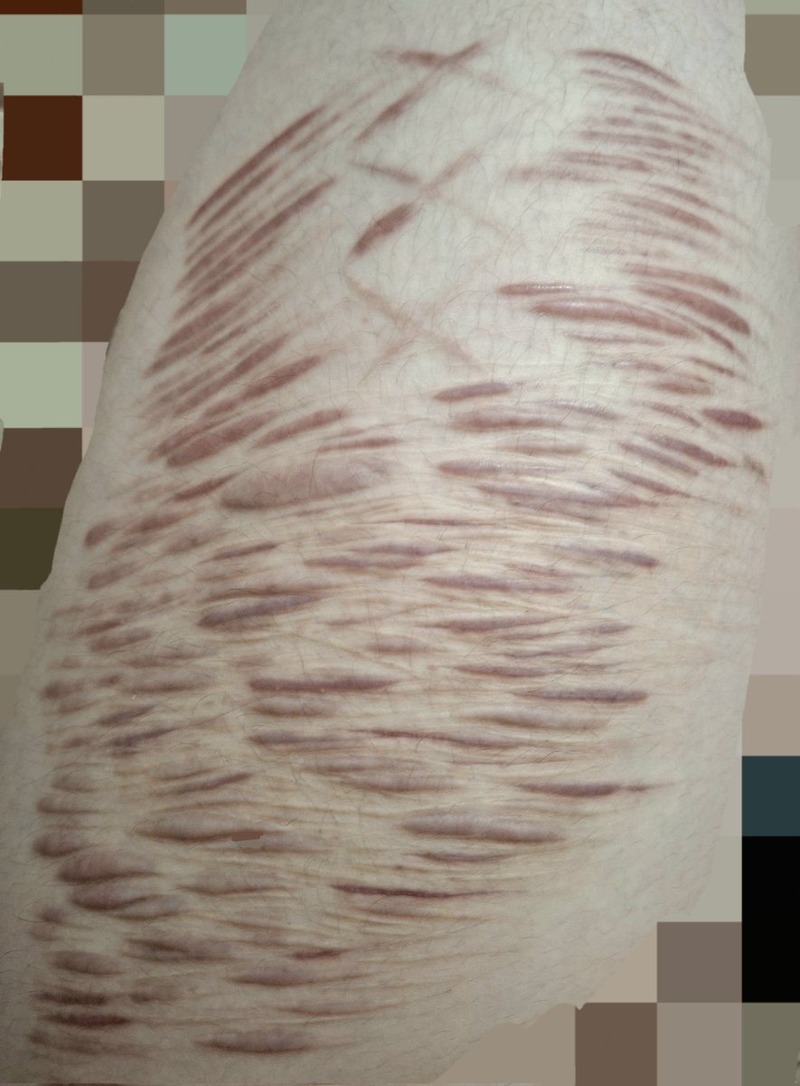 okeoke299091's tweet photo. I really like how my left thigh look:-) #selfharm https://t.co/Ss0qamB8DD