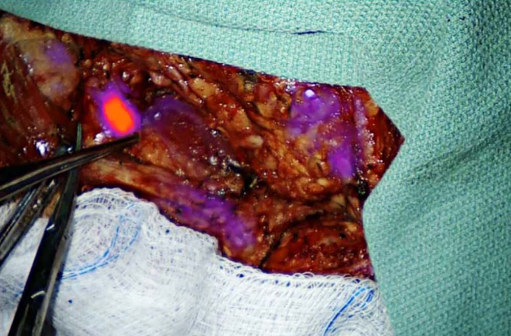 𝐅𝐥𝐮𝐨𝐫𝐞𝐬𝐜𝐞𝐧𝐜𝐞 𝐆𝐮𝐢𝐝𝐞𝐝 𝐒𝐮𝐫𝐠𝐞𝐫𝐲 𝐒𝐲𝐬𝐭𝐞𝐦 𝐌𝐚𝐫𝐤𝐞𝐭 𝐈𝐧𝐝𝐮𝐬𝐭𝐫𝐲 𝐑𝐞𝐬𝐞𝐚𝐫𝐜𝐡 2025-2033

𝐑𝐞𝐚𝐝 𝐦𝐨𝐫𝐞: reportsandinsights.com/report/fluores…