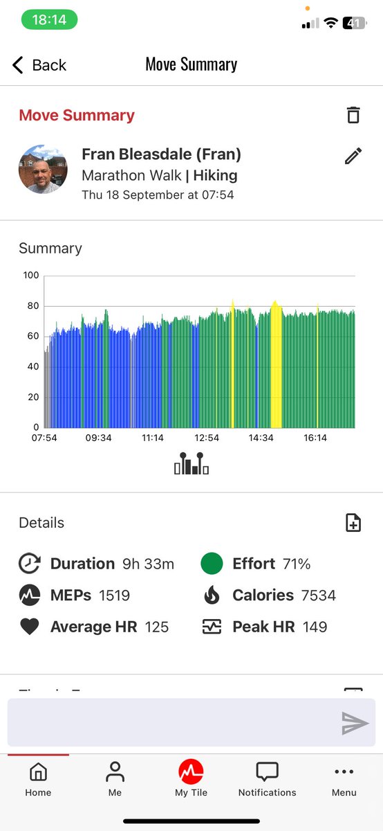 Fran Bleasdale tweet media