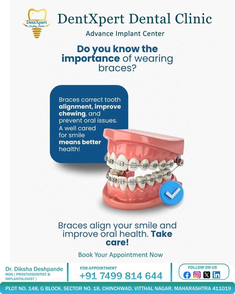 Dentxpert_'s tweet photo. Do you know the importance of wearing braces?
Braces correct tooth alignment, improve chewing, and prevent oral issues.
A well cared for smile means better health!
Braces align your smile and improve oral health. Take care!
#toothache #dentist #dental #dentalcare #teeth #dentist https://t.co/tY4hLYshBU