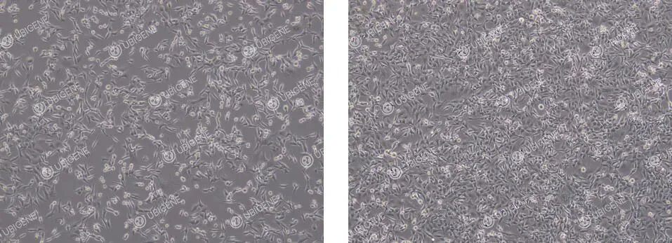 🧑‍🔬Master MC38 cell culture &amp; gene editing! Thawing, passaging, transfection &amp; cloning tips for tumor immunology models. Ensure healthy growth &amp; reliable results.  💨Boost your oncology research: ubigene.us/application/mc…
#MC38 #GeneEditing #crispr #science #research #Biology