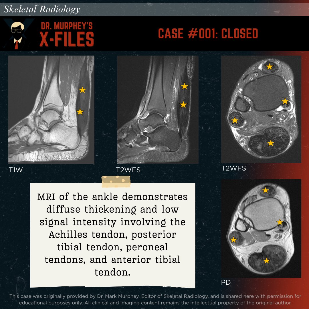 Skeletal Radiology tweet media