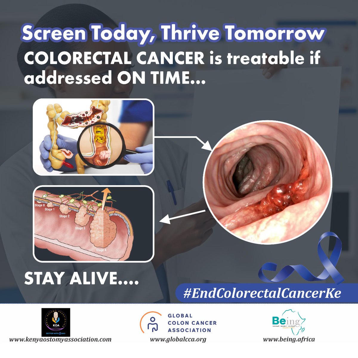 Being_Africa's tweet photo. Colorectal cancer often starts as harmless polyps in the colon, but some can turn cancerous if unchecked. Regular screening is vital. Early detection saves lives. 
👉 Don’t wait for symptoms. Get screened today and encourage a loved one. Together, we can #EndColorectalCancerKE https://t.co/2hVV3dReQ6
