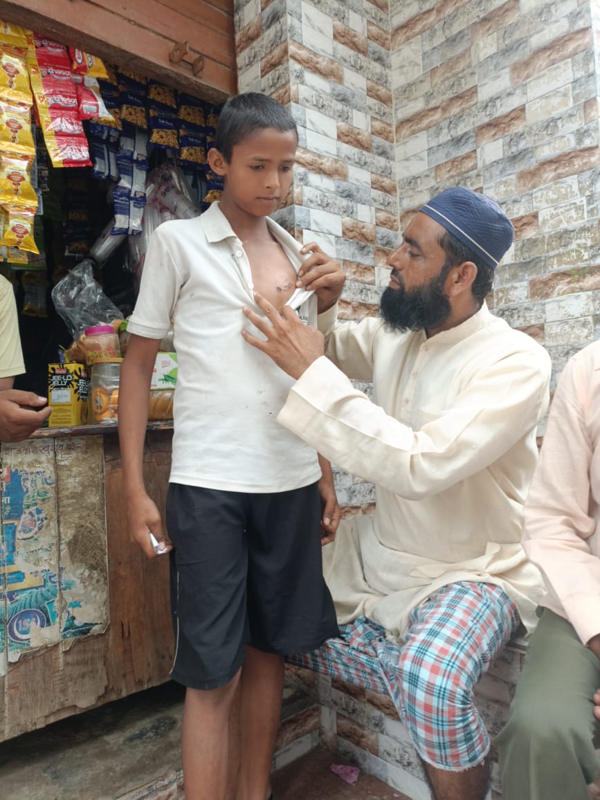 sharikrahim313's tweet photo. इससे पूरे क्षेत्र में दहशत का माहौल है और लोग सुरक्षित महसूस नहीं कर रहे हैं।
अतः निवेदन है कि तत्काल वन विभाग व नगर पालिका की टीम भेजकर इन कुत्तों को पकड़कर ले जाया जाए तथा जिन लोगों को कुत्तों ने काटा है, उन्हें तुरंत इलाज उपलब्ध कराया जाए।
आपकी त्वरित कार्रवाई से ग्रामीणों को https://t.co/7B9ONF3nma