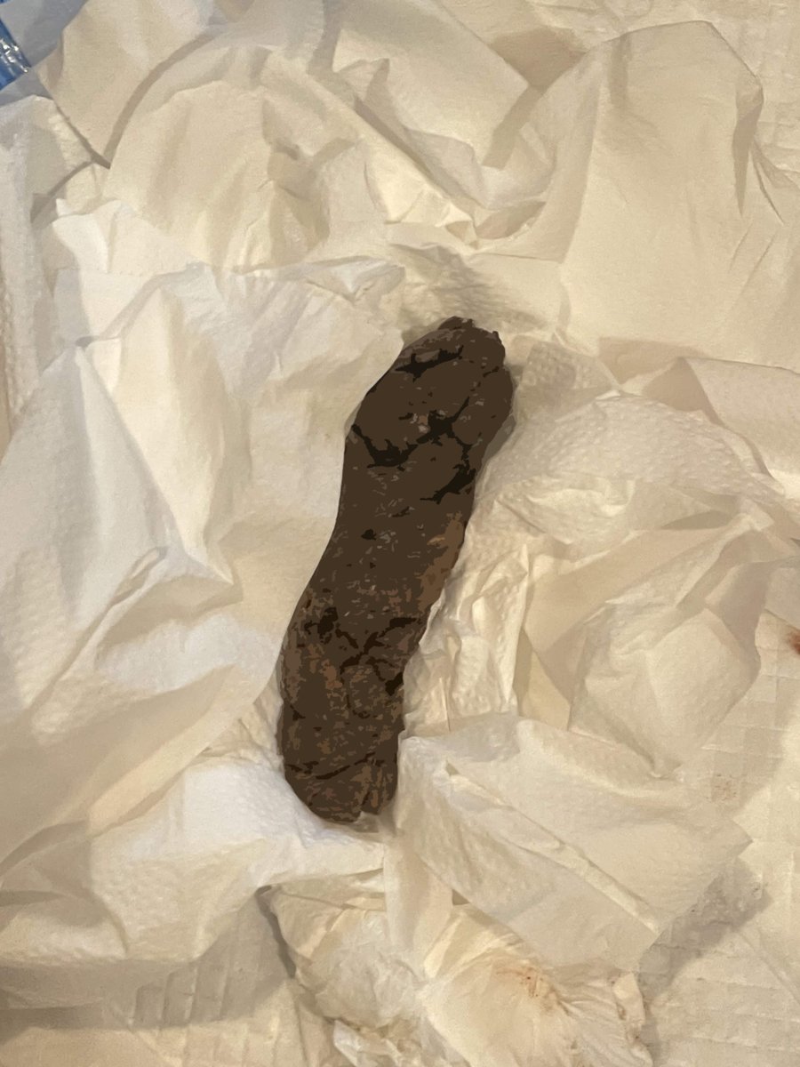 ScatTokyo_Sayo's tweet image. Had a healthy meal yesterday
And yep… produced one perfectly healthy log 💕💩

Feeling good, feeling clean ✨