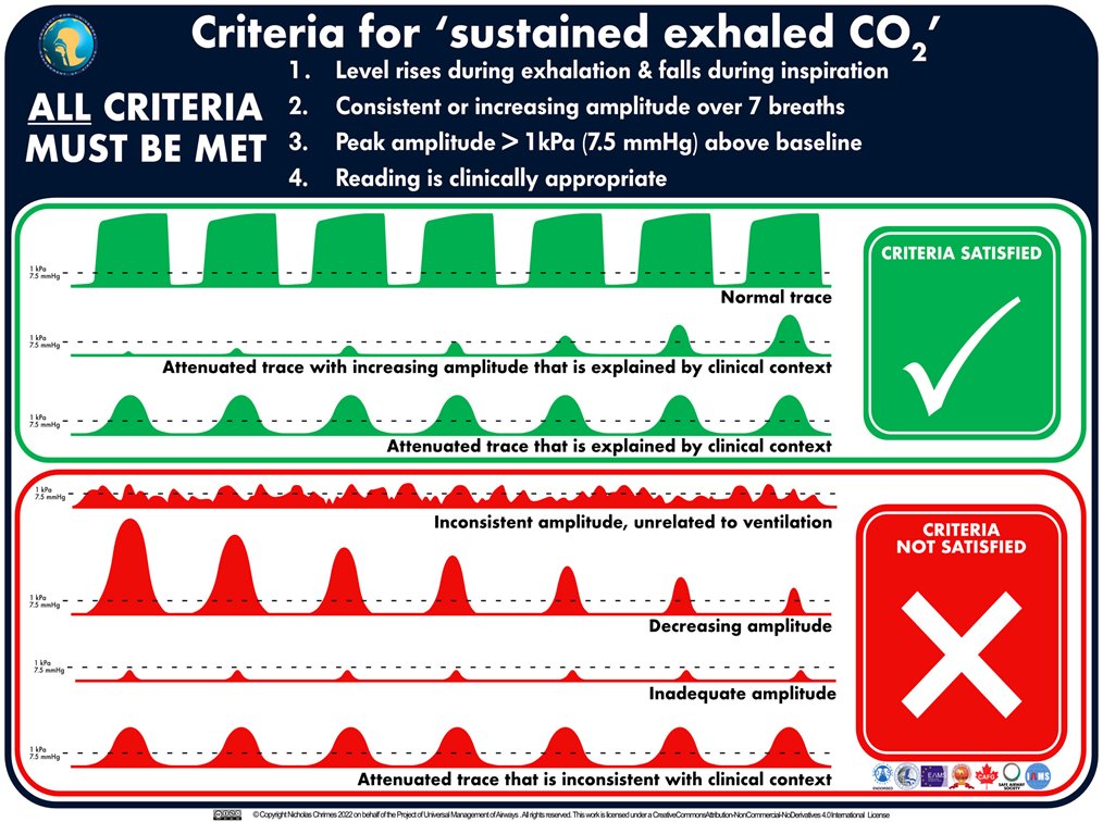 alistair mcnarry (@altgm) on Twitter photo Delighted to be at <a href="/Assoc_Anaes/">Association of Anaesthetists</a> #AC2025
with the vital message about Sustained Exhaled CO2.
Sustained Exhaled CO2 | The Royal College of Anaesthetists
This is supported by <a href="/RCoANews/">Royal College of Anaesthetists</a>, the AoA and <a href="/dasairway/">Difficult Airway Society (DAS)</a> <a href="/dasresidents/">Difficult Airway Society (DAS) Residents</a> <a href="/CollegeODP/">College Of Operating Department Practitioners</a>
Please retweet, and #verbaliseandconfirm Delighted to be at <a href="/Assoc_Anaes/">Association of Anaesthetists</a> #AC2025
with the vital message about Sustained Exhaled CO2.
Sustained Exhaled CO2 | The Royal College of Anaesthetists
This is supported by <a href="/RCoANews/">Royal College of Anaesthetists</a>, the AoA and <a href="/dasairway/">Difficult Airway Society (DAS)</a> <a href="/dasresidents/">Difficult Airway Society (DAS) Residents</a> <a href="/CollegeODP/">College Of Operating Department Practitioners</a>
Please retweet, and #verbaliseandconfirm