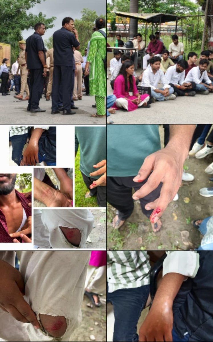 AlokDinu's tweet photo. Dalit-Bahujan Students Brutally Attacked by ABVP Goons in BBAU, Lucknow. For standing up against the ABVP agenda on campus, students were thrashed, humiliated, and targeted in an act of casteist violence.
Rise &amp; Resist Caste Oppression!
#StopCasteViolence #JusticeForBBAUStudents https://t.co/m1ezXH0LZr