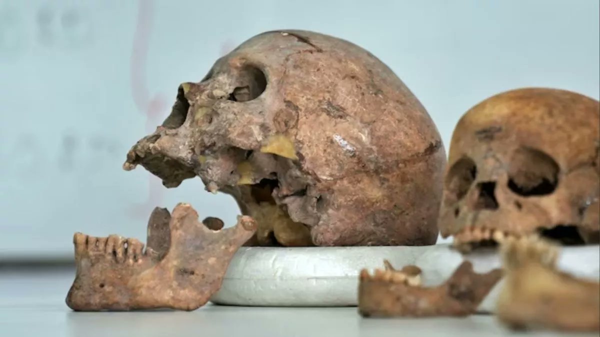 Rashtra_TV's tweet image. कर्नाटक के धर्मस्थल विवाद में नया मोड़: जांच कर रही एसआईटी को घटनास्थल से 7 खोपड़ियां मिलीं, ज्यादातर मिडिल एज पुरुषों की। फोरेंसिक जांच में अहम जानकारी मिलने की संभावना। खोपड़ियां लगभग एक साल पुरानी बताई जा रही हैं।
#Karnataka #SITInvestigation #ForensicUpdate #BreakingNews…