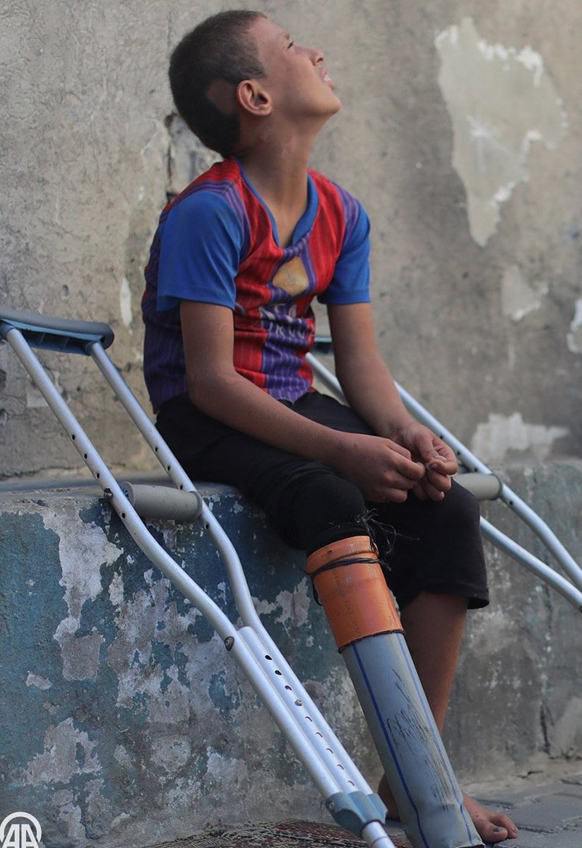 Gazzeli Ratib…

Saldırılarda hem anneciğini hem de bir bacağını kaybetti.
Kendi imkânlarıyla, plastik bir borudan yaptığı protezle hayata tutunmaya çalışıyor.
Seni hem yarım hem de yalnız bırakanların bahçeleri çiçek görmesin.