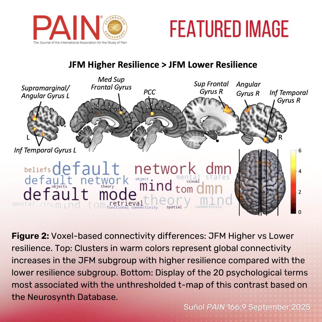 PAIN Journal tweet media