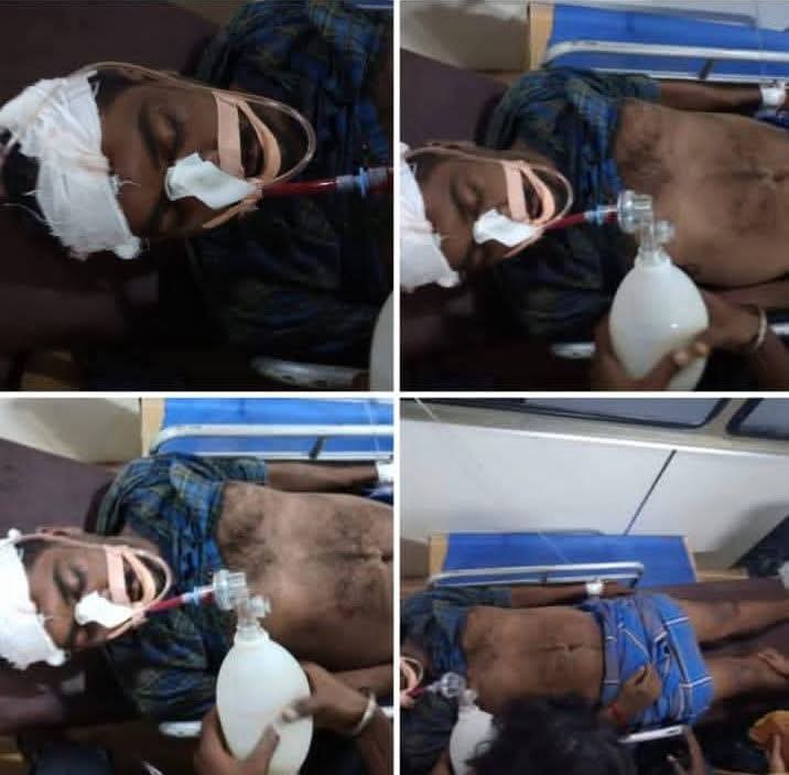 தலித்(பறையர்) சாதி வெறியர்களால் கல்,கம்பி இவைகளால் தலையில் கொடூரமாக தாக்கப்பட்ட மேலூர் சுக்காம்பட்டியைச் சார்ந்த தேவரின இளைஞர் படுகொலை

நடுநிலை/போலி வேடதாரிகள் வேடங்களை கலைத்துவிட்டு வாய் திறக்கவேண்டும்

இந்த கொலையை மெத்தனமாக கையாண்ட காவல்துறைக்கு வன்மையான கண்டனங்கள் 😡
#மேலூர்