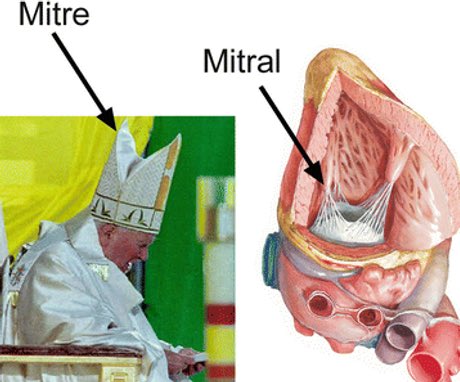 سُمي صمام القلب الميترالي على أسم القبعة التي يرتديها البابا