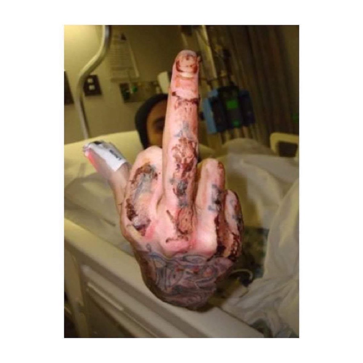 blink182italia's tweet image. On this day 17 years ago, Travis Barker survived.