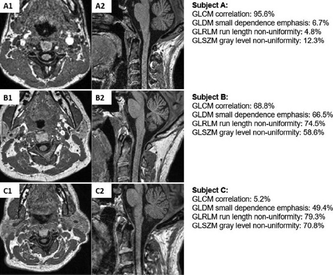 Journal of Neuroimaging tweet media
