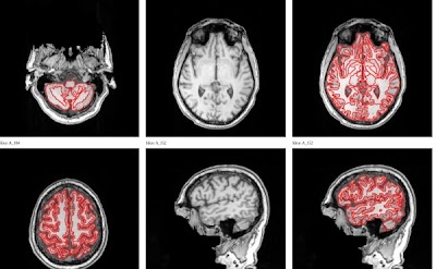 Radiology: Artificial Intelligence tweet media