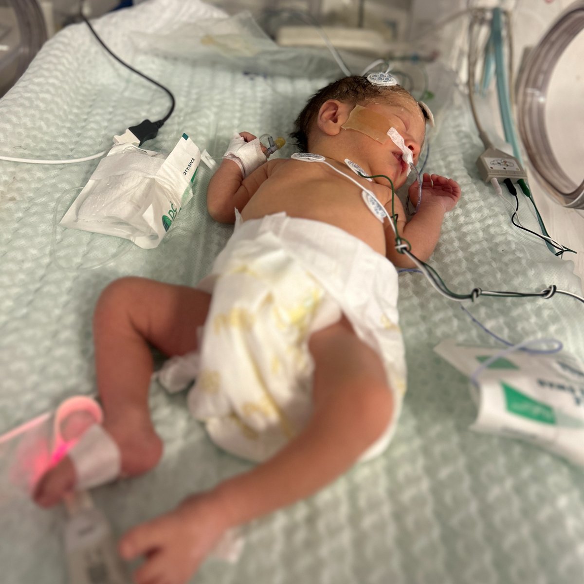 Together with a dozen physician residents and a dozen nurse and midwife trainees, our hospital’s staff deliver 12 or more babies every day.💛

#Babies #NICU #Newborns #Healthcare