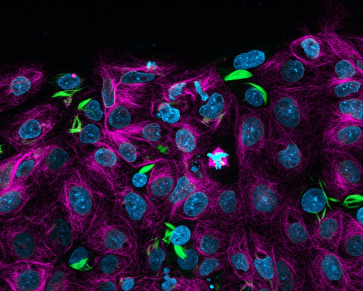 RogersLabUCD's tweet image. Happy to share these gorgeous images of a section of a developing chicken brain with fiery green, orange, and blue microtubules and explanted #NeuralCrest cells with green actin and pink microtubules taken by @CamiloE_ on this #FluorescenceFriday. #DevBio