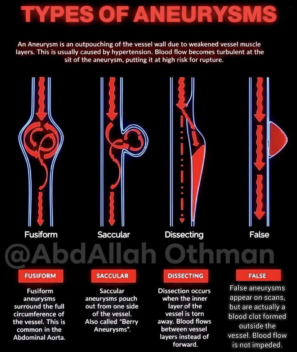 Zain Khalpey, MD, PhD, FACS tweet media