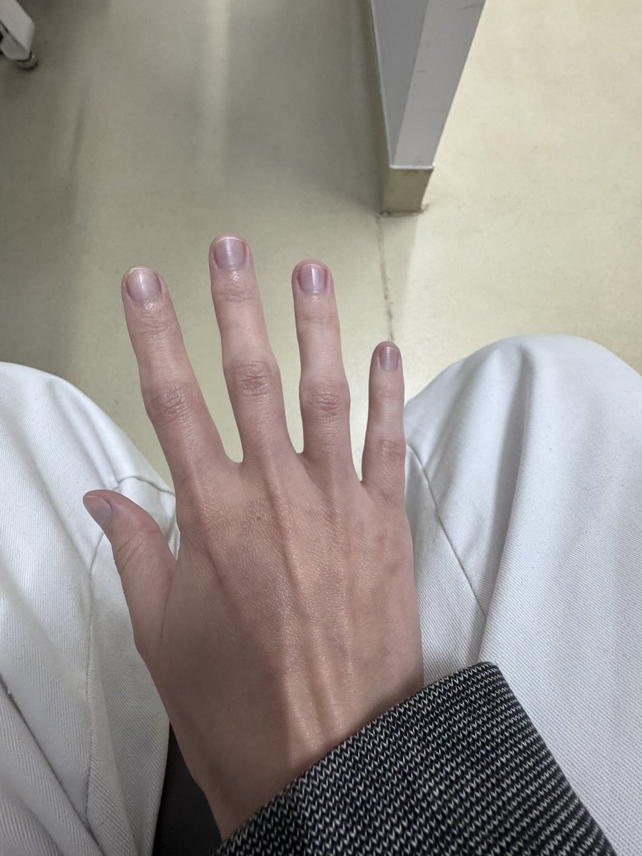 bulimic4ever's tweet photo. Hate feeling cold but ❤️ it at the same time #edtwtㅤ #edtwt #edtwtthread #ana #anatwt #mia #miatwt #3dtwt #fatt #fatspo #fat #pig #piggy #hands #ricecake #ricecaketwt #meanspo #fatgirl #bodycheck #cold #coldhands https://t.co/MGHJBA07FP