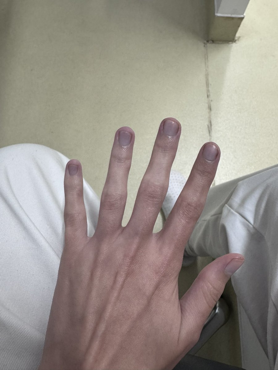 bulimic4ever's tweet photo. Hate feeling cold but ❤️ it at the same time #edtwtㅤ #edtwt #edtwtthread #ana #anatwt #mia #miatwt #3dtwt #fatt #fatspo #fat #pig #piggy #hands #ricecake #ricecaketwt #meanspo #fatgirl #bodycheck #cold #coldhands https://t.co/MGHJBA07FP