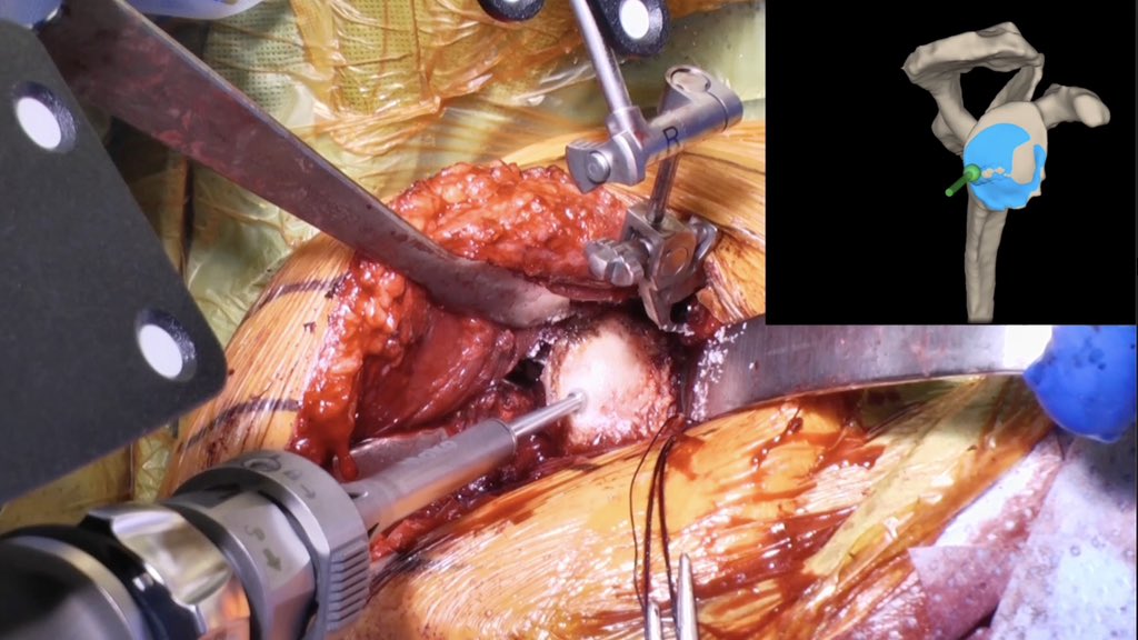 Erick Marigi, MD tweet media