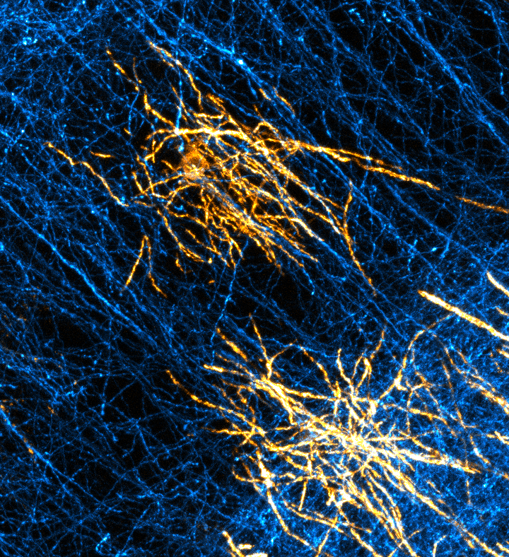 Which track do I choose: ON #FluorescenceFriday, a pair of newly formed oligodendrocytes encounter a field of neuronal axons. Later in development, they will wrap around and insulate subset of these axons