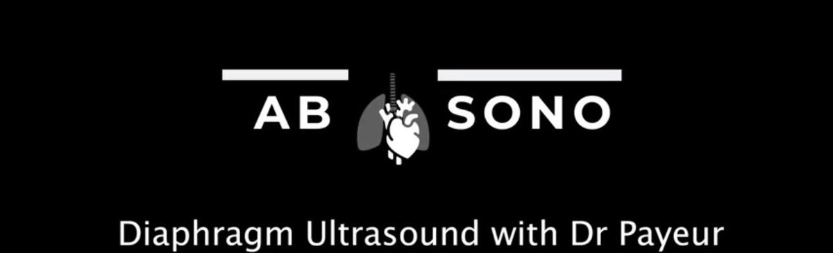 Want to learn more about diaphragm ultrasound? Look here:  albertasono.ca/thoracic-ultra…  <a href="/ThinkingCC/">Philippe Rola</a> <a href="/IM_Crit_/">IMCrit</a> <a href="/UAlberta_ICU/">UAlberta Crit Care</a> <a href="/UAlberta_FoMD/">UAlberta Med & Dent</a> <a href="/drshahrul80/">Syed Shahrul Naz</a> <a href="/iceman_ex/">Segun Olusanya (He/Him) iceman_ex@critcare.social</a> <a href="/TomJelic/">Tom Jelic</a> <a href="/NephroP/">NephroPOCUS</a> <a href="/trigeminy_henry/">Sonographic_Tendencies</a> <a href="/ross_prager/">Ross Prager</a> #POCUS #FOAMed
