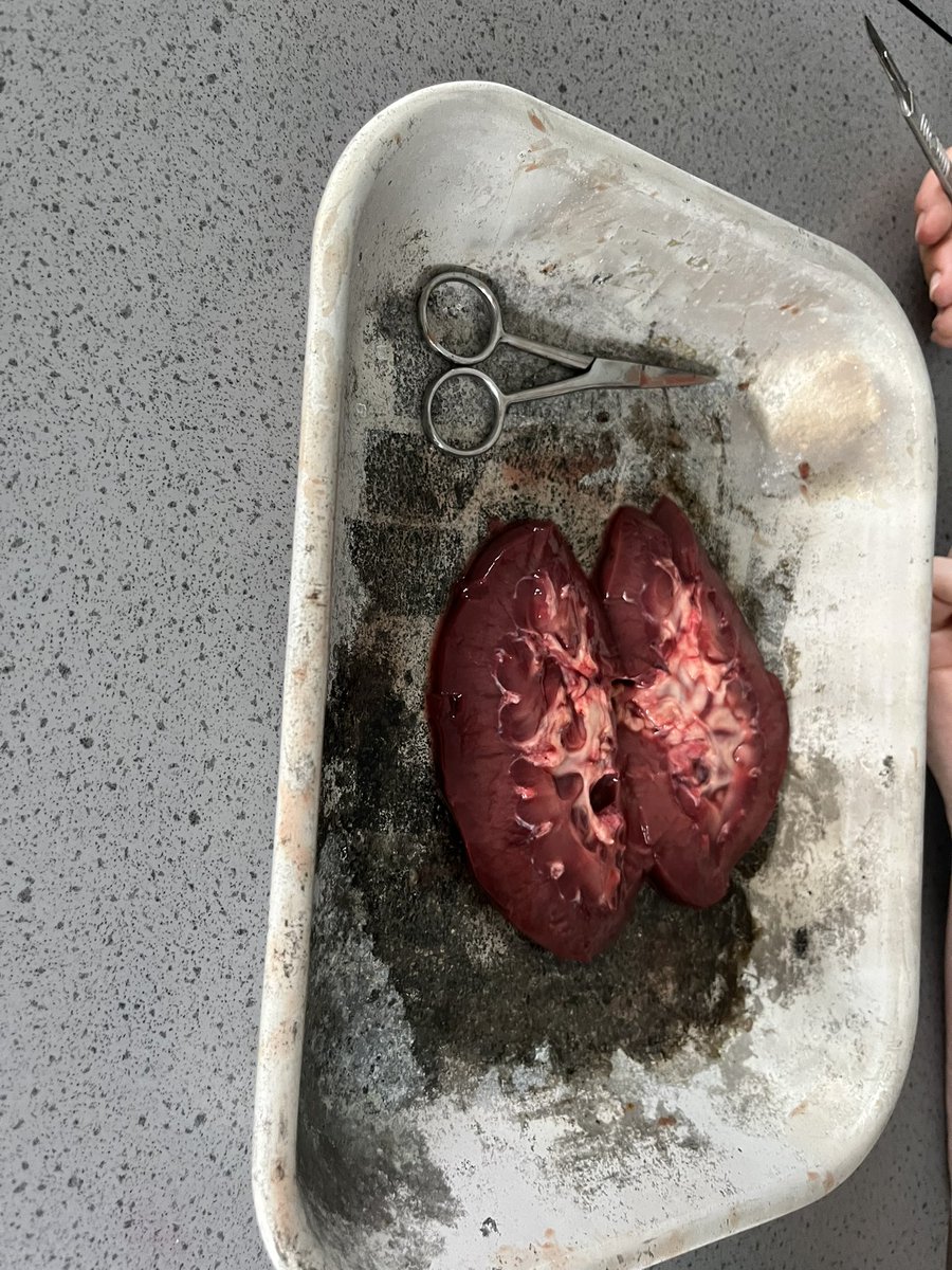 Denise Ralph (MIScT RSciTech) WH Tech (@whtech) on Twitter photo Year 11 did kidney dissection yesterday it was a good lesson so engaged π
<a href="/TECHOGNITIONUK/">#TECHOGNITION</a>
<a href="/Philip_HarrisUK/">Philip Harris</a>
<a href="/Preproom/">Preproom.org</a>
<a href="/JPBiology/">Jack</a>
#samplesforschools Year 11 did kidney dissection yesterday it was a good lesson so engaged π
<a href="/TECHOGNITIONUK/">#TECHOGNITION</a>
<a href="/Philip_HarrisUK/">Philip Harris</a>
<a href="/Preproom/">Preproom.org</a>
<a href="/JPBiology/">Jack</a>
#samplesforschools