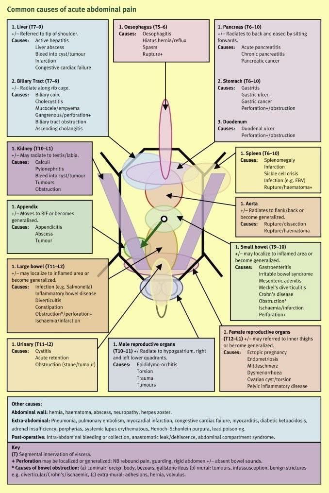 Causes of acute abdominal pain