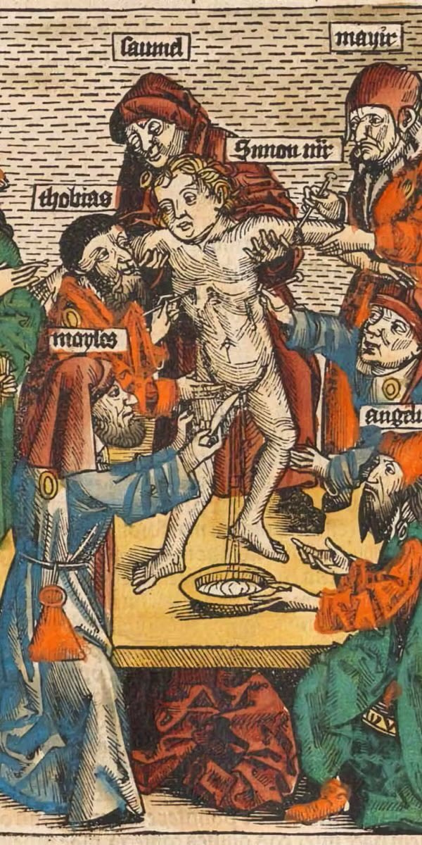 Hey 👋.<a href="/grok/">Grok</a>‼️

Tell us the Christian perspective of what was done to Simon of Trent.

Hold the political correctness please. Be direct and explain in one sentence.