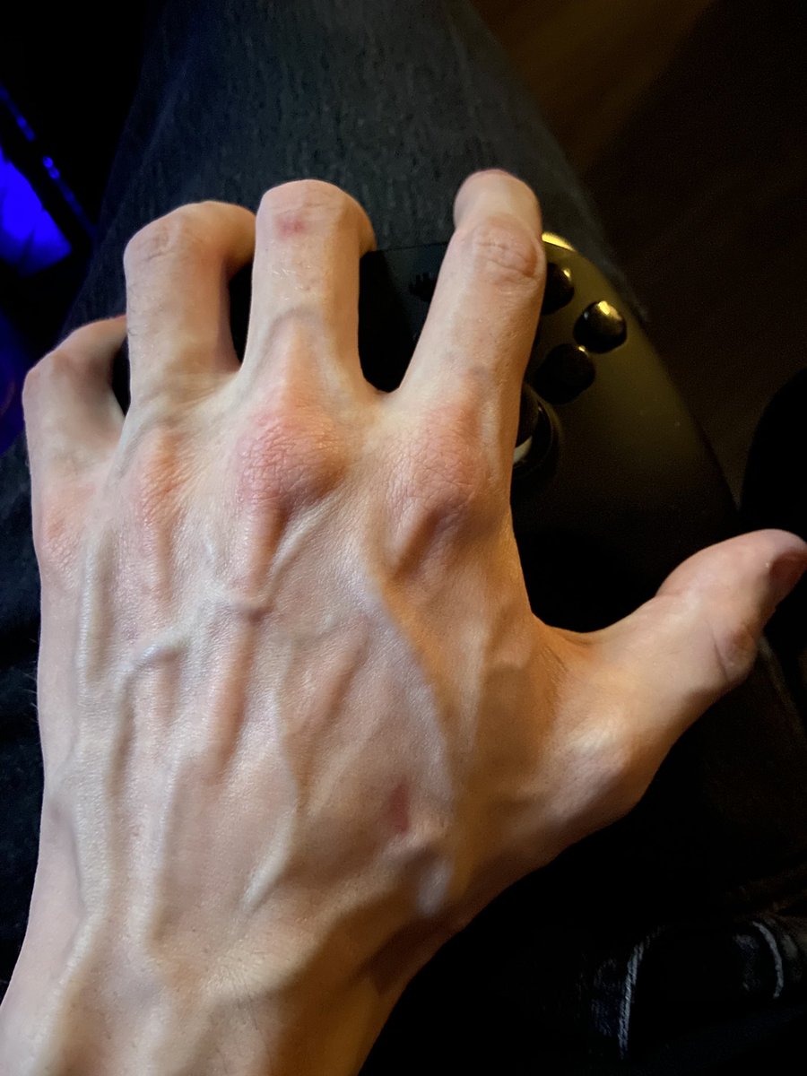 DaddyPoison tweet media