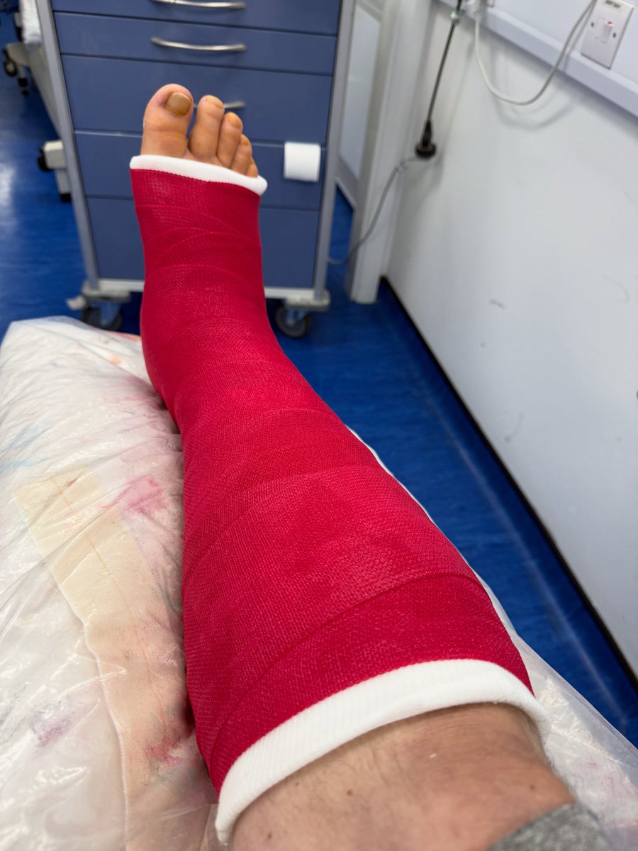 darrenref1's tweet photo. 4 weeks today I broke my fibula and fractured my ankle refereeing a football match
Can’t work. Can’t go out. Can’t go on holiday with my family. Can’t do anything. 
Feeling really pissed off. 
No contact with outside world other than texts.
I’m bored and I’m just done https://t.co/pAwfOHsjDN