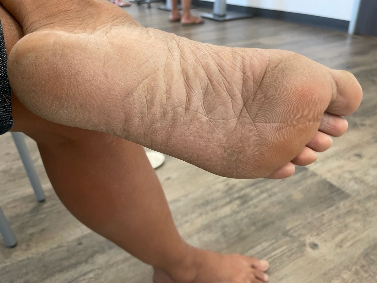 MrLoveClub Model: Granny A 
Size: 7.5
Stench: 6/10 (Stinky)

Full Photoset &amp; Video on mrloveoffeet.com