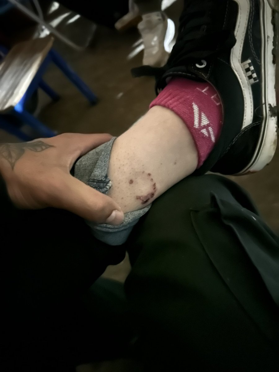 Me diske le mordió un perro…. Creer o es en otro?