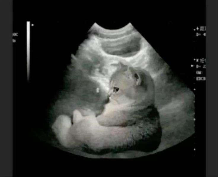 Guys it's happening, me n raf are expecting. Y'all are invited to the baby shower 🫶