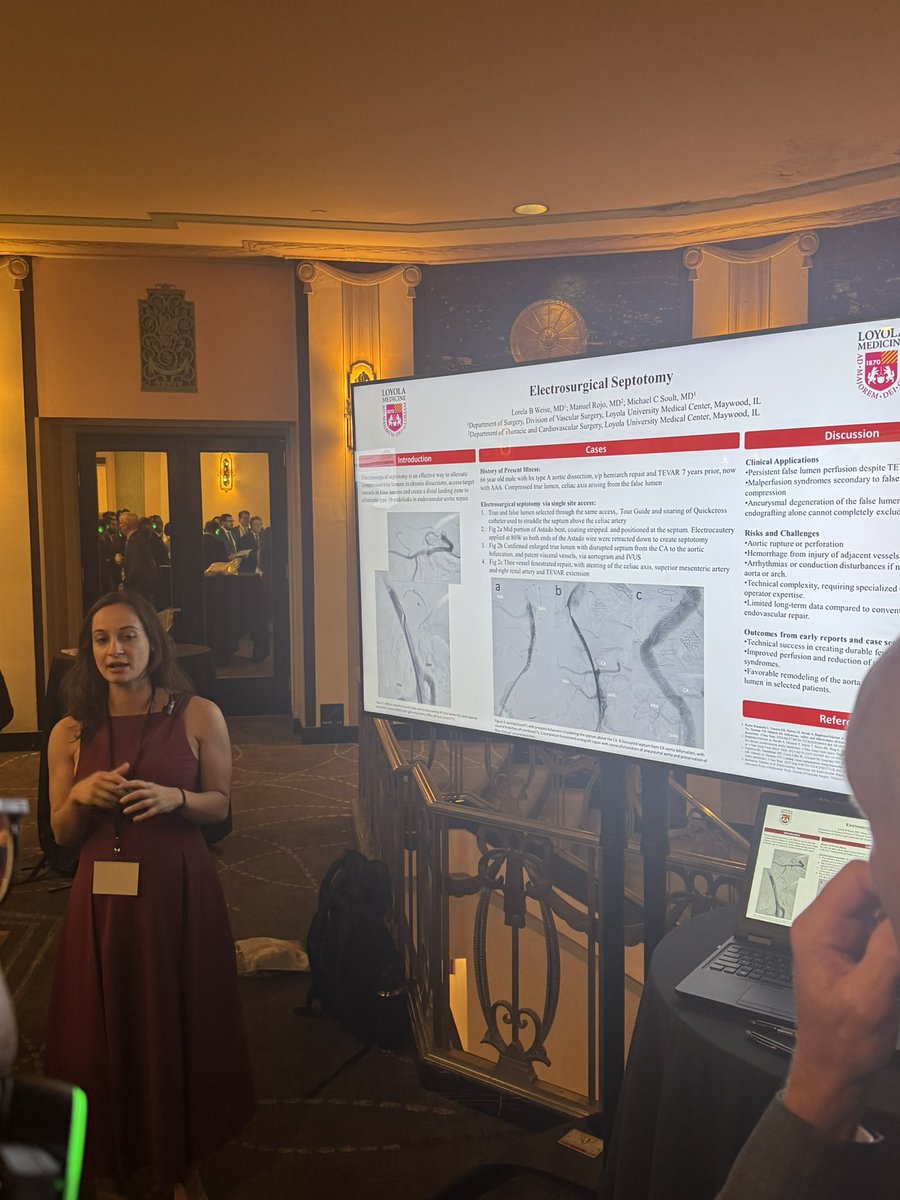 Great presentation on our experience with endoseptal fenestration by <a href="/LorelaWeise/">Lorela B Weise, MD, BS</a>! <a href="/LoyolaVascular/">Loyola Vascular Surg</a> <a href="/BAulivolaMD/">Bernadette Aulivola</a> <a href="/loyolasurg_dept/">Loyola's Department of Surgery</a>