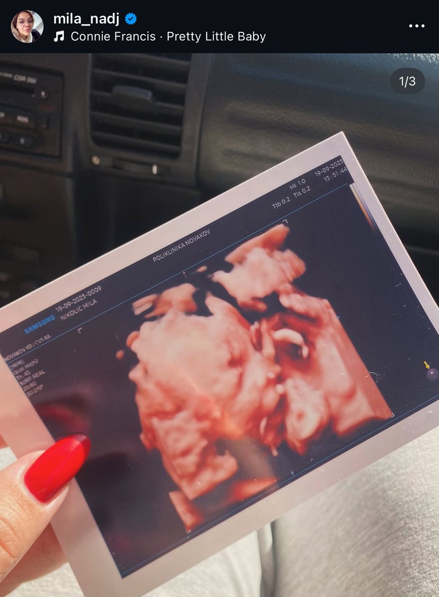 Nakon svega kroz šta je prošla u poslednje vreme Mila ostade trudna sa novim partnerom 🥰 #caosvima #tagživota #samosuse