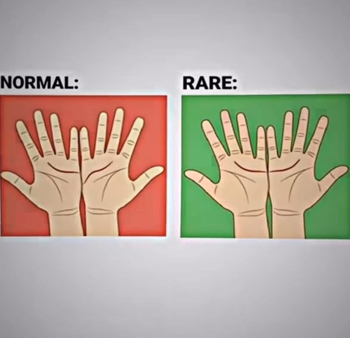 maximumpain333's tweet image. What are you?
Normal or Rare?

✨🙌🏾💫