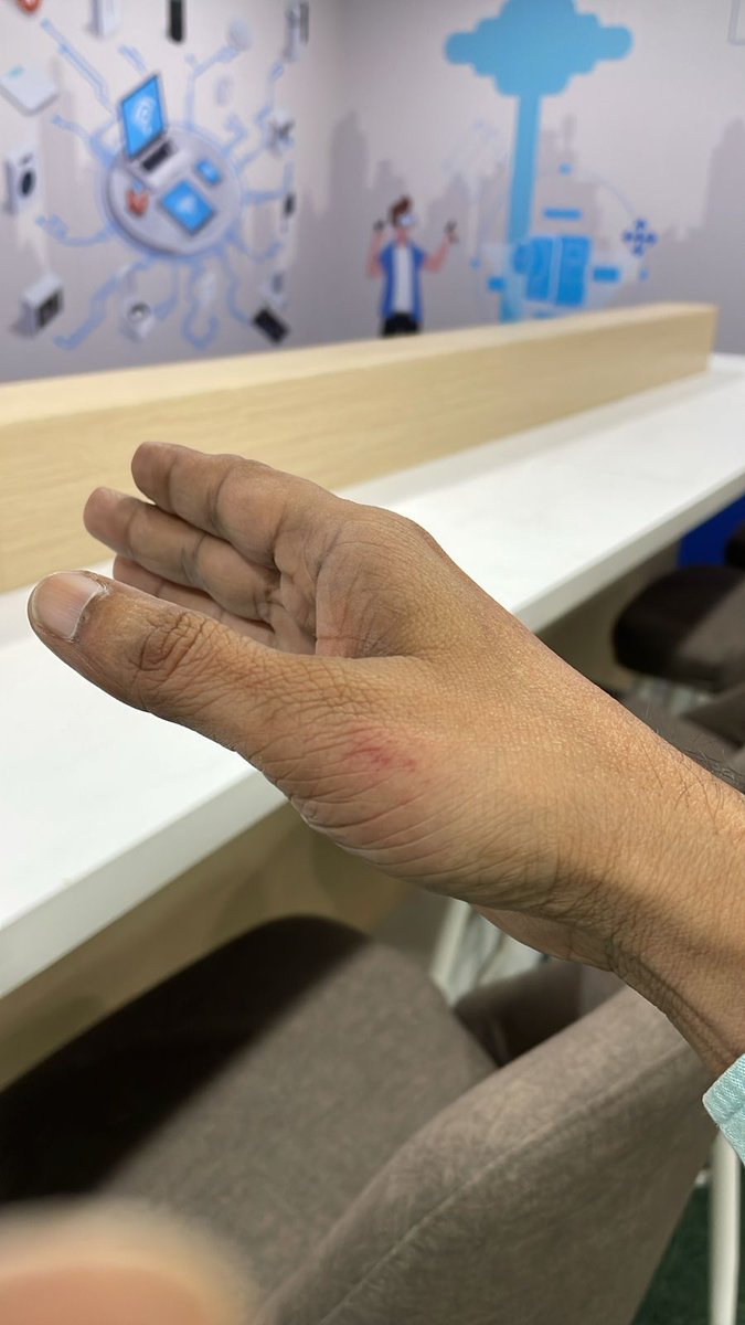 sachinfogat's tweet photo. #JusticeForSachinKumar
#StopHRAbuse
#TCSAssaultCase
#CorporateAccountability
#FightForSeverance
🚨 Shocking Incident 🚨
On 19 Sept 2025, I, Sachin Kumar, ex-employee of TCS Yamuna Office, Noida, was physically assaulted by TCS HR 
#JusticeForSachinKumar #TCSAssaultCase https://t.co/AxoZ4AVsHc