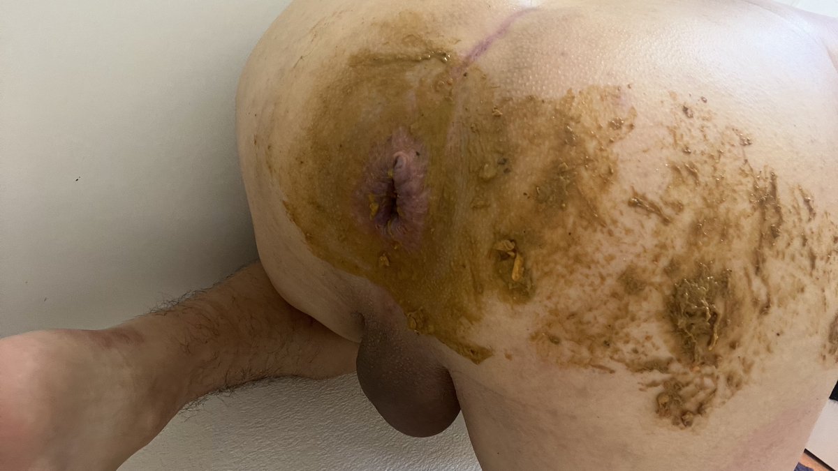 Shitaddict8 tweet media