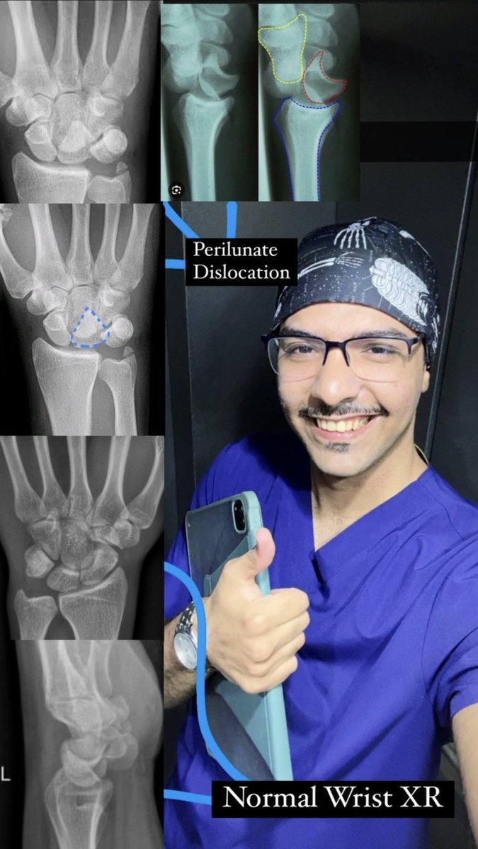 OMAR23tv's tweet photo. My passion: Orthopedics https://t.co/OIHYgtXd6o