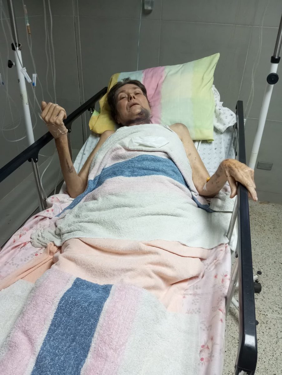 AYUDA URGENTE

Queridos amigos y contactos. Por medio de la presente quería pedirles ayuda para mi amiga de la infancia Brenda. Muchos la conocen por aquí con el nombre de <a href="/fierecillla_/">Bren</a> 

Ella sufrió una aparatosa caída que le ha causado múltiples problemas y en este momento