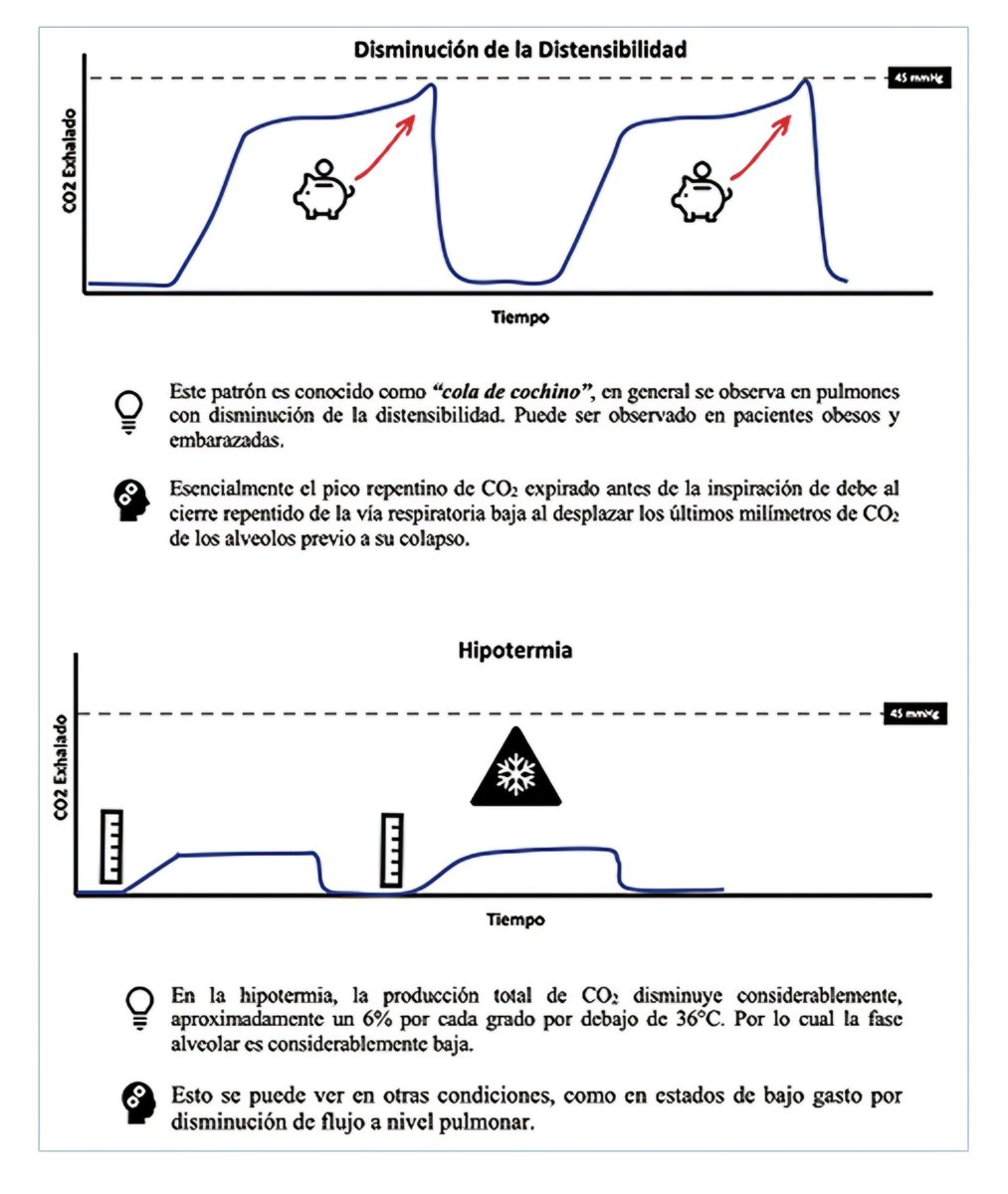 Capnografía; a través de las curvas.

Desde la importancia de la correcta colocación del tubo endotraqueal, el broncoespasmo, obstrucción mecanica en la ventilacion y mas...

Rev. Chil. Anest. 2025; 54 (2): 101-110
DOI: 10.25237/revchilanestv54n2-01. 
#intubación #ventilacion